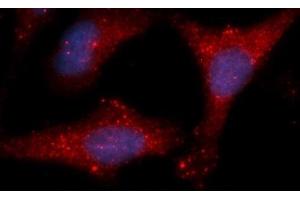 Immunofluorescence (IF) image for anti-Lactate Dehydrogenase B (LDHB) (AA 1-334) antibody (APC) (ABIN5565783) (LDHB 抗体  (AA 1-334) (APC))