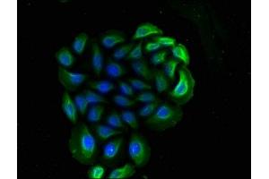 Immunofluorescence staining of A549 cells with ABIN7160185 at 1:90, counter-stained with DAPI. (CD14 抗体  (AA 20-345))