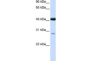 WB Suggested Anti-GCDH Antibody Titration:  0. (GCDH 抗体  (N-Term))