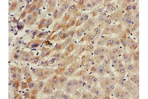 Immunohistochemistry of paraffin-embedded human liver tissue using ABIN7143187 at dilution of 1:100 (ACAD11 抗体  (AA 225-388))