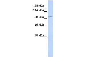 WB Suggested Anti-TRPC6 Antibody Titration:  0.