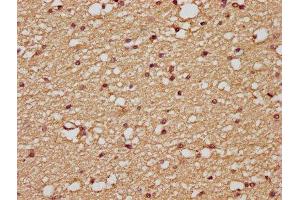 IHC image of ABIN7175125 diluted at 1:200 and staining in paraffin-embedded human brain tissue performed on a Leica BondTM system. (PLAUR 抗体  (AA 23-305))