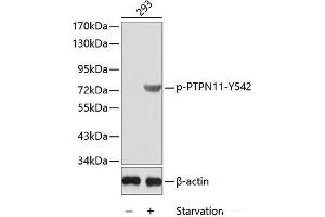 Western blot analysis of extracts from 293 cells using Phospho-PTPN11(Y542) Polyclonal Antibody.