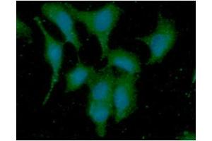 ICC/IF analysis of DYNLL in A549 cells line, stained with DAPI (Blue) for nucleus staining and monoclonal anti-human DYNLL antibody (1:100) with goat anti-mouse IgG-Alexa fluor 488 conjugate (Green). (DYNLL1 抗体)