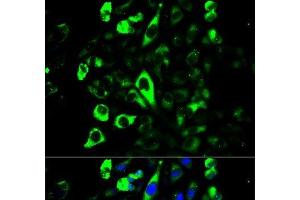 Immunofluorescence analysis of U2OS cells using GZMB Polyclonal Antibody (GZMB 抗体)
