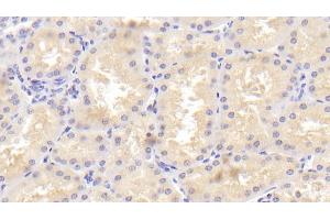 Detection of TANK in Human Kidney Tissue using Polyclonal Antibody to TRAF Family Member Associated NFKB Activator (TANK) (TANK 抗体  (AA 131-369))