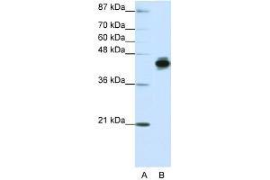 WB Suggested Anti-KRT18 Antibody Titration:  1. (Cytokeratin 18 抗体  (N-Term))