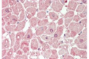 Rabbit Anti-PLA2G5 antibody  Formalin Fixed Paraffin Embedded Tissue: Human Heart Primary antibody Concentration: 1:100 Secondary Antibody: Donkey anti-Rabbit-Cy3 Secondary Antibody Concentration: 1:200 Magnification: 20x Exposure Time: 0. (PLA2G5 抗体  (N-Term))