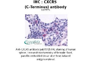 Image no. 1 for anti-Chemokine (C-X-C Motif) Receptor 5 (CXCR5) (C-Term) antibody (ABIN1733411) (CXCR5 抗体  (C-Term))