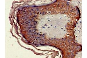 Immunohistochemistry of paraffin-embedded human skin tissue using ABIN7160462 at dilution of 1:100 (MNDA 抗体  (AA 84-233))