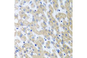 Immunohistochemistry of paraffin-embedded human liver injury using PRMT2 antibody at dilution of 1:100 (x40 lens). (PRMT2 抗体)