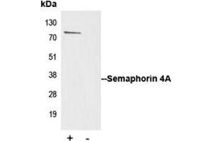 Immunoprecipitation of Semaphorin 4A from 0. (Sema4a 抗体  (Center))