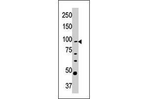 Western blot analysis of CPT1A polyclonal antibody  in Y-79 cell line lysate (35 ug/lane). (CPT1A 抗体  (C-Term))