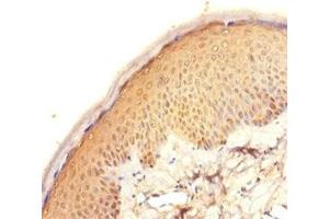 Immunohistochemistry of paraffin-embedded human skin tissue using ABIN7165631 at dilution of 1:100 (C11orf73 抗体  (AA 1-197))