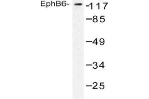 Western blot (WB) analysis of EphB6 antibody in extracts from COLO cells. (EPH Receptor B6 抗体)