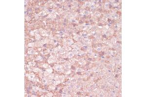 Immunohistochemistry (IHC) image for anti-Cytochrome P450, Family 11, Subfamily B, Polypeptide 2 (CYP11B2) (AA 234-503) antibody (ABIN1679468)