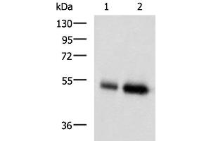 Western blot analysis of Human placenta tissue and Human right lower lung tissue lysates using BMP5 Polyclonal Antibody at dilution of 1:450 (BMP5 抗体)