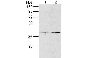 Western Blot analysis of Hela and lovo cell using PDGFRL Polyclonal Antibody at dilution of 1:400 (PDGFRL 抗体)