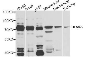 Western blot analysis of extracts of various cell lines, using IL5RA antibody. (IL5RA 抗体)