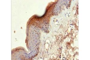 Immunohistochemistry of paraffin-embedded human skin tissue using ABIN7157440 at dilution of 1:100 (KRT6A 抗体  (AA 305-564))