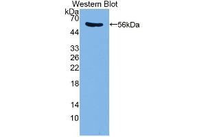 Western blot analysis of the recombinant protein. (PDE4D 抗体  (AA 581-809))