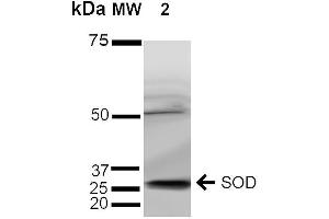 Western blot analysis of Human Cervical Cancer cell lysates (HeLa) showing detection of ~35 kDa SOD (EC) protein using Rabbit Anti-SOD (EC) Polyclonal Antibody .