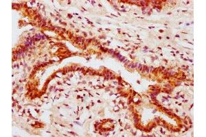 Immunohistochemistry (IHC) image for anti-V-Akt Murine Thymoma Viral Oncogene Homolog 1 (AKT1) (pSer473) antibody (ABIN7127677)