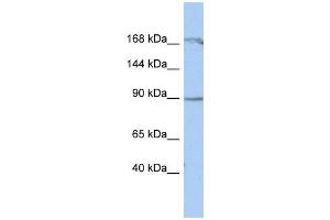 NARG1 antibody used at 1 ug/ml to detect target protein. (NAA15 抗体  (Middle Region))