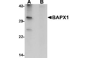 Western blot analysis of BAPX1 in human brain tissue lysate with BAPX1 antibody at 1 µg/mL in (A) the absence and (B) the presence of blocking peptide. (NKX3-2 抗体  (Middle Region))