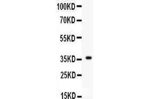 Western Blotting (WB) image for anti-Fibroblast Growth Factor 1 (Acidic) (FGF1) (AA 22-146) antibody (ABIN3042389) (FGF1 抗体  (AA 22-146))