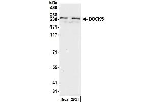 anti-Dedicator of Cytokinesis 5 (Dock5) (AA 350-400) antibody