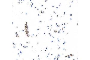 Immunocytochemistry (ICC) image for anti-Platelet Derived Growth Factor Receptor alpha (PDGFRA) (AA 24-525) antibody (ABIN7453344) (Recombinant PDGFRA 抗体  (AA 24-525))