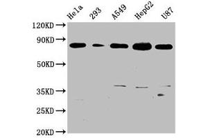 Western Blot Positive WB detected in: Hela whole cell lysate, 293 whole cell lysate, A549 whole cell lysate, HepG2 whole cell lysate, U87 whole cell lysate All lanes: BAG3 antibody at 0. (Recombinant BAG3 抗体)