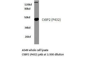 Western blot (WB) analysis of CtBP2 antibody in extracts from A549 cells. (CTBP2 抗体)