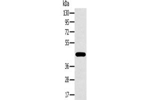 Western Blotting (WB) image for anti-Melanoma Antigen Family A, 10 (MAGEA10) antibody (ABIN2423753) (MAGEA10 抗体)