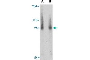 Western blot analysis of BICD2 in A-549 cell lysate with BICD2 polyclonal antibody  at (A) 1 and (B) 2 ug/mL . (BICD2 抗体  (Internal Region))