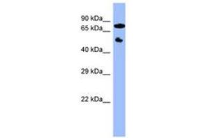Image no. 1 for anti-Cytochrome P450, Family 11, Subfamily B, Polypeptide 2 (CYP11B2) (C-Term) antibody (ABIN6741746) (CYP11B2 抗体  (C-Term))
