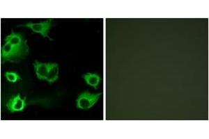 Immunofluorescence analysis of COS7 cells, using CYSLTR1 Antibody. (CysLTR1 抗体  (AA 131-180))