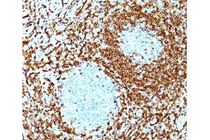 Immunohistochemistry (Formalin-fixed Paraffin-embedded Sections) (IHC (fp)) image for anti-B-Cell CLL/lymphoma 2 (BCL2) (AA 41-54) antibody (ABIN3024194)