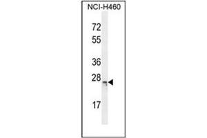 Western blot analysis of C16orf45 Antibody (Center) in NCI-H460 cell line lysates (35ug/lane). (C16orf45 抗体  (Middle Region))