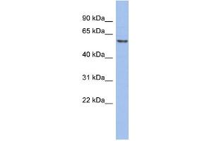 Western Blotting (WB) image for anti-General Transcription Factor IIH, Polypeptide 1, 62kDa (GTF2H1) (Middle Region) antibody (ABIN2792659)
