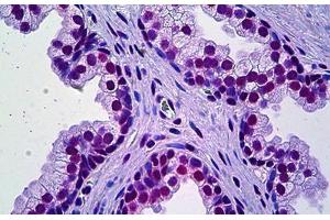 Human Prostate: Formalin-Fixed, Paraffin-Embedded (FFPE) (PRKDC 抗体  (AA 4019-4129))