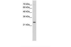 Image no. 1 for anti-Thyroid Stimulating Hormone Receptor (TSHR) (C-Term) antibody (ABIN6736337) (TSH receptor 抗体  (C-Term))