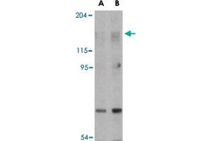Western blot analysis of RPTOR in L1210 cell lysate with RPTOR polyclonal antibody  at (A) 2 and (B) 4 ug/mL . (Raptor 抗体  (N-Term))