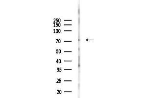 anti-Interleukin 12 Receptor, beta 2 (IL12RB2) (C-Term) antibody