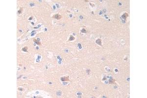 Used in DAB staining on fromalin fixed paraffin- embedded brain tissue (Cathepsin W 抗体  (AA 22-376))