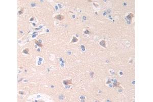 Used in DAB staining on fromalin fixed paraffin- embedded brain tissue (Cathepsin W 抗体  (AA 22-376))