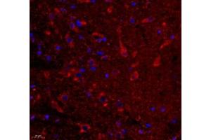 Immunofluorescence of paraffin embedded rat substantia nigra using VIRL2 (ABIN7076206) at dilution of 1: 700 (400x lens) (VN1R2 抗体)