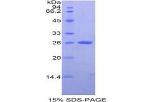 SDS-PAGE analysis of Rat APC Protein. (APC 蛋白)