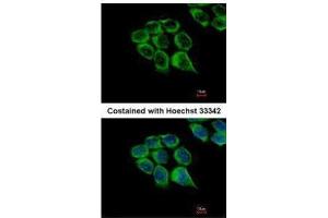 ICC/IF Image Immunofluorescence analysis of methanol-fixed HCT116, using C1r, antibody at 1:500 dilution. (C1R 抗体)